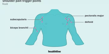 Do Massage Therapy Help Frozen Shoulder?