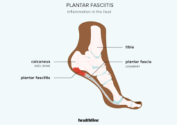 How to Deal with Chronic Foot Pain?