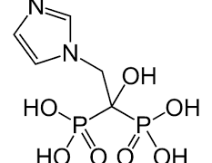 Benefits of Intravenous Treatment for Osteoporosis.