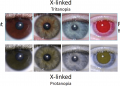 Eye Color Genetics: The Science Behind Eye Paternity Testing