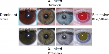 Eye Color Genetics: The Science Behind Eye Paternity Testing