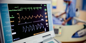 Can Anxiety Disorder Cause EKG/ECG Abnormalities?